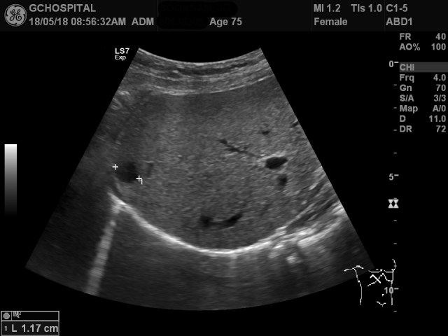 00138305_US_2018051875_20180518_001 1