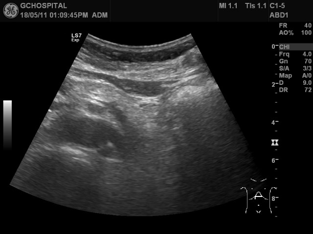 US20180511130836_US_NO_20180511_002