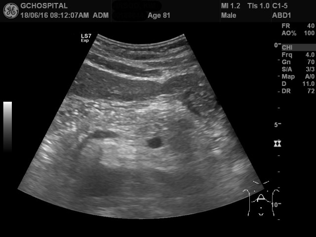 00186044_US_2018061655_20180616_001 1