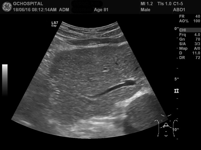 00186044_US_2018061655_20180616_002 1