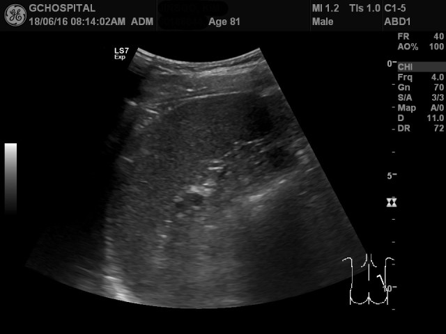 00186044_US_2018061655_20180616_004 1