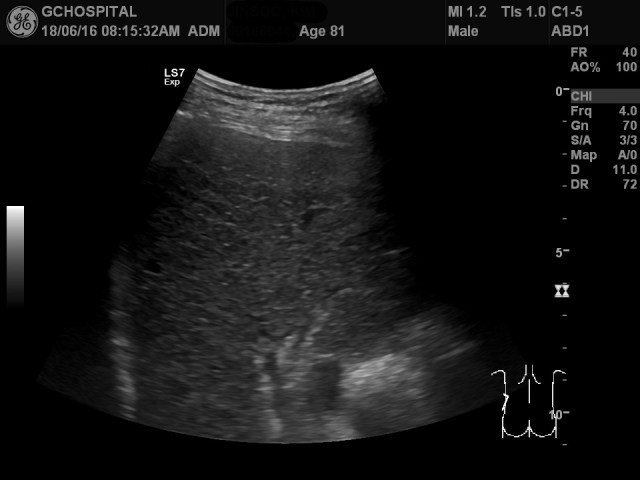 00186044_US_2018061655_20180616_005 1