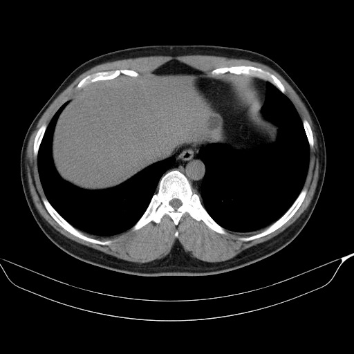 00222049_CT_20180608229_20180608_001