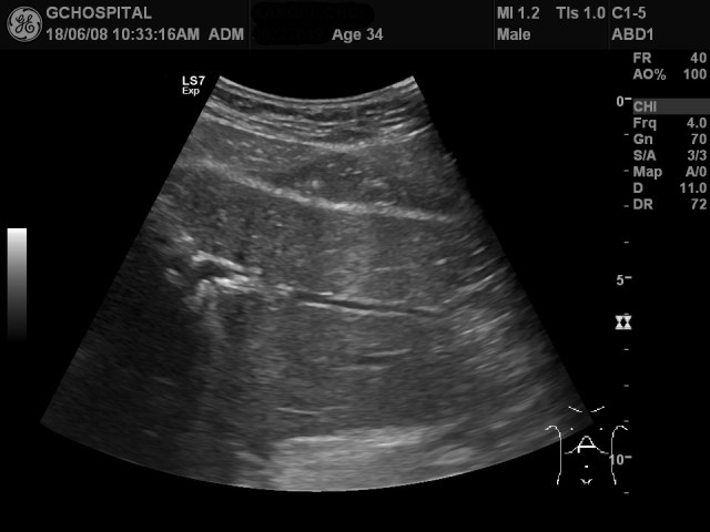 00222049_US_20180608230_20180608_002