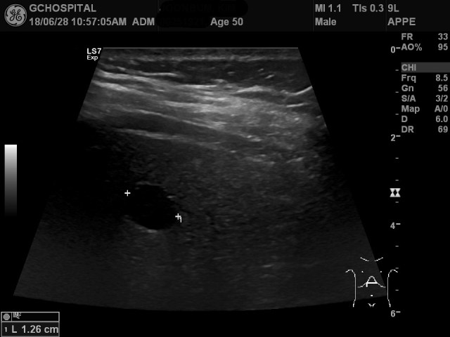 00251921_US_20180628264_20180628_002