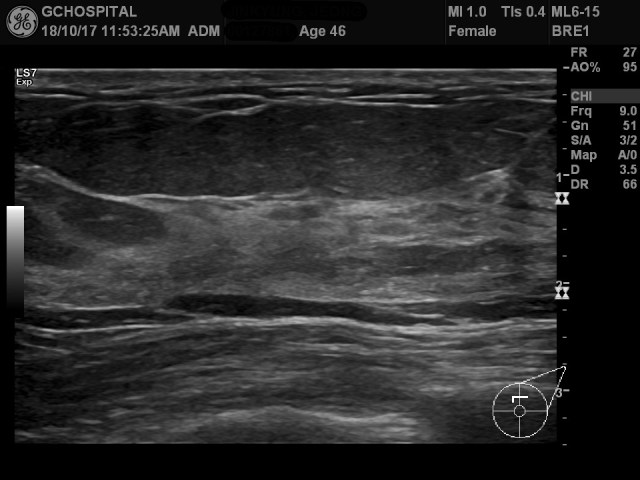 00127861_US_20181017354_20181017_001