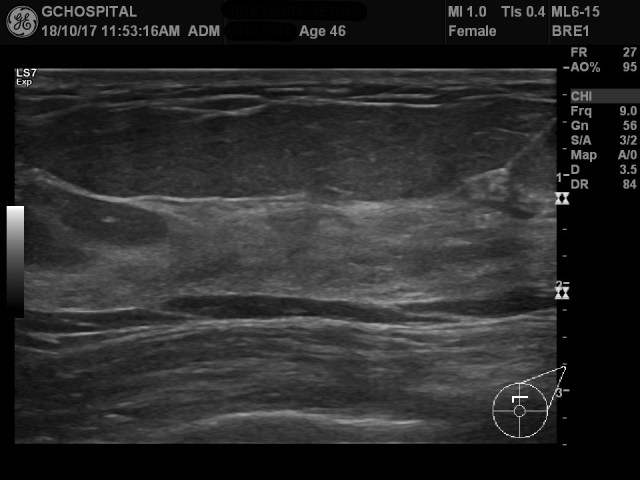 00127861_US_20181017354_20181017_002