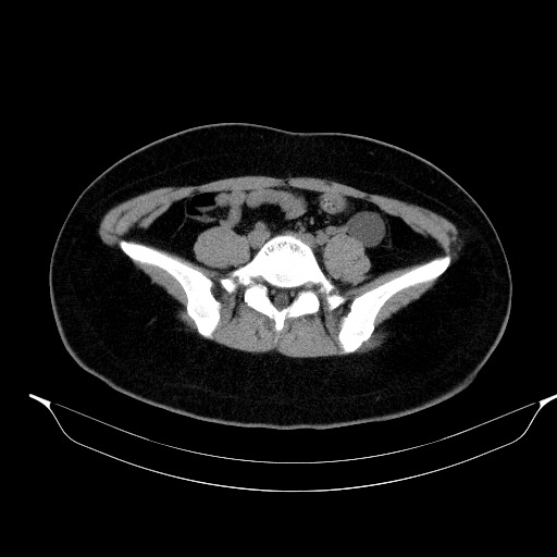 00230515_CT_20181102276_20181102_003