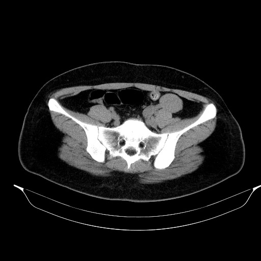 00230515_CT_20181102276_20181102_004