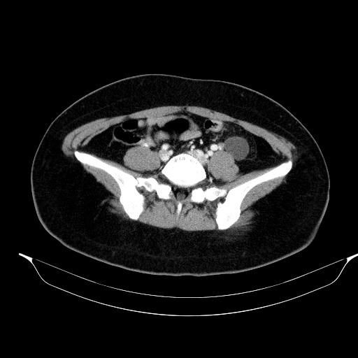 00230515_CT_20181102276_20181102_005