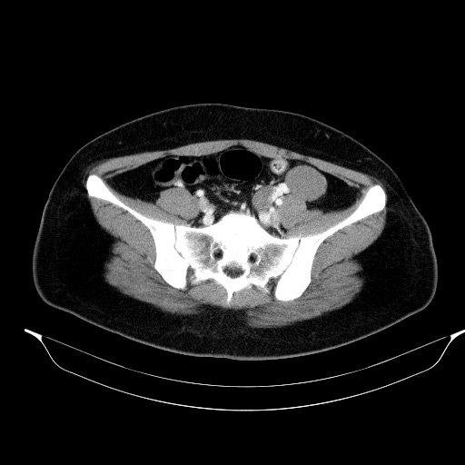 00230515_CT_20181102276_20181102_006