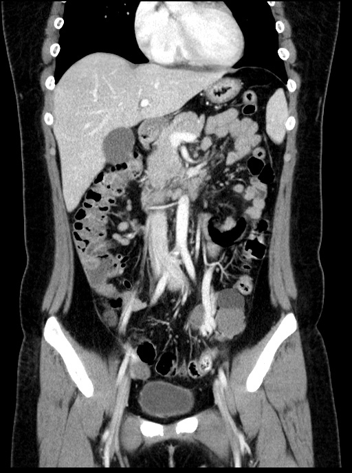 00230515_CT_20181102276_20181102_007