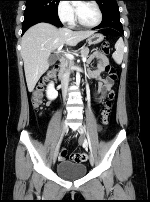 00230515_CT_20181102276_20181102_008