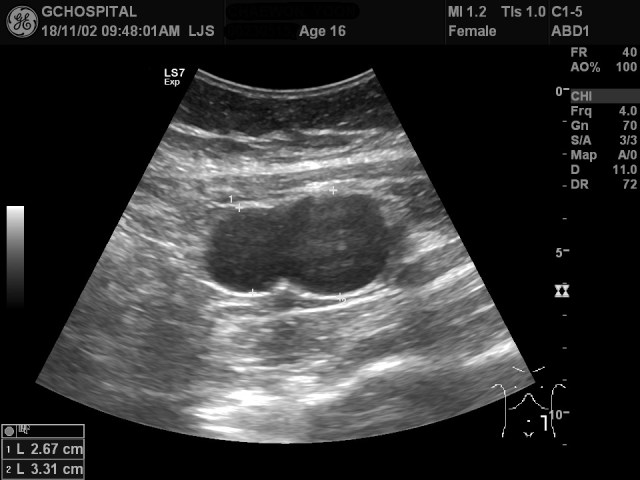 00230515_US_20181102159_20181102_001