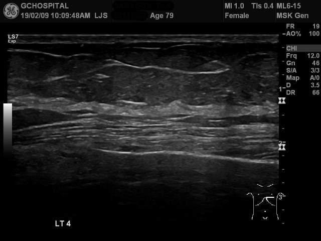 00131602_US_20190209170_20190209_003