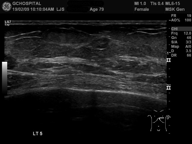 00131602_US_20190209170_20190209_004