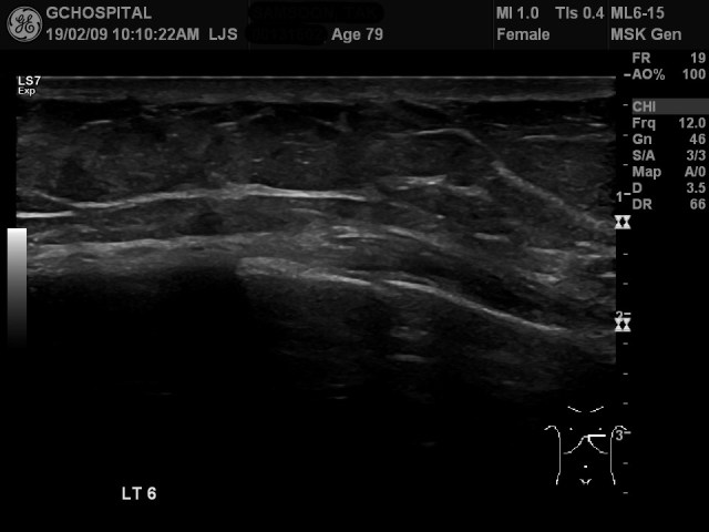 00131602_US_20190209170_20190209_006