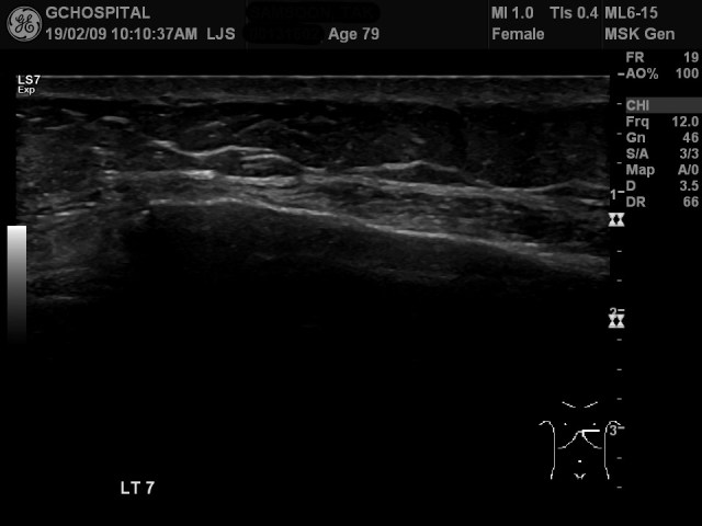 00131602_US_20190209170_20190209_007