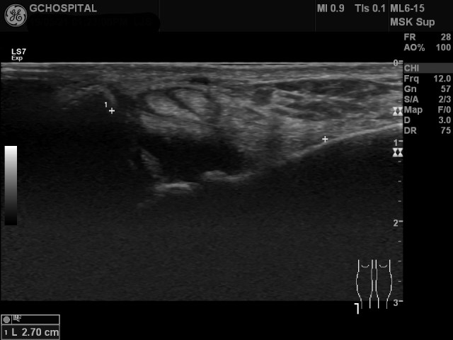 US20190521132312_US_NO_20190521_001