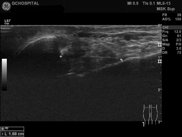 US20190521132312_US_NO_20190521_002