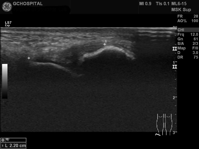 US20190521132312_US_NO_20190521_003