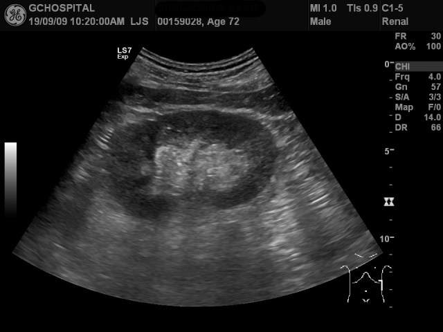 00159028_US_20190909197_20190909_001