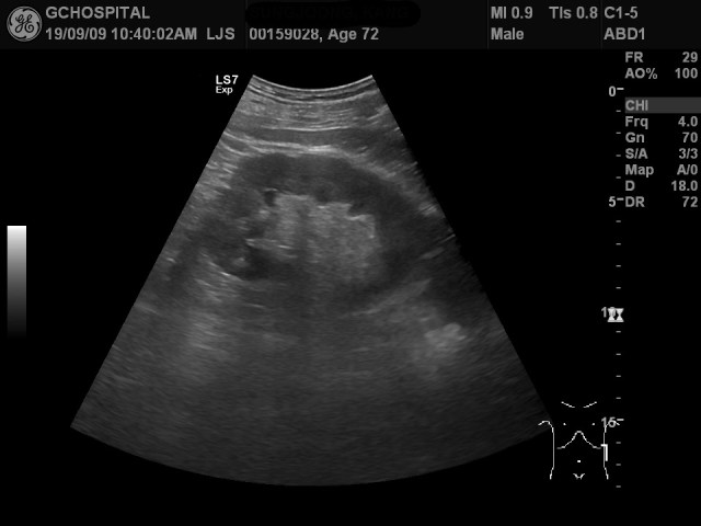 00159028_US_20190909242_20190909_004