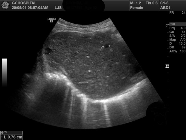 00127554_US_20200501115_20200501_002