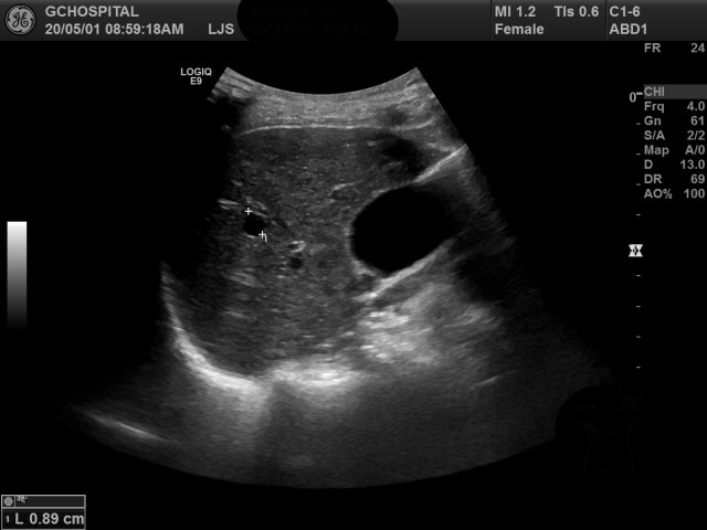 00127554_US_20200501115_20200501_003