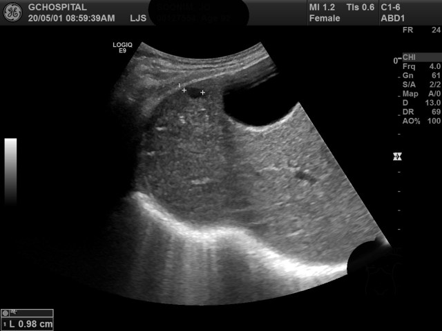 00127554_US_20200501115_20200501_004