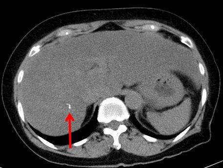 fig2